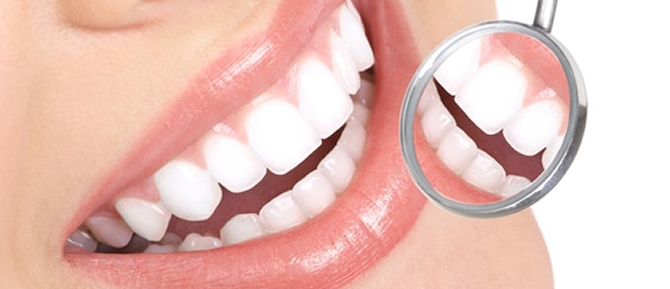 Teeth Whitening in Al Ain - Happy Smile Dental Clinic